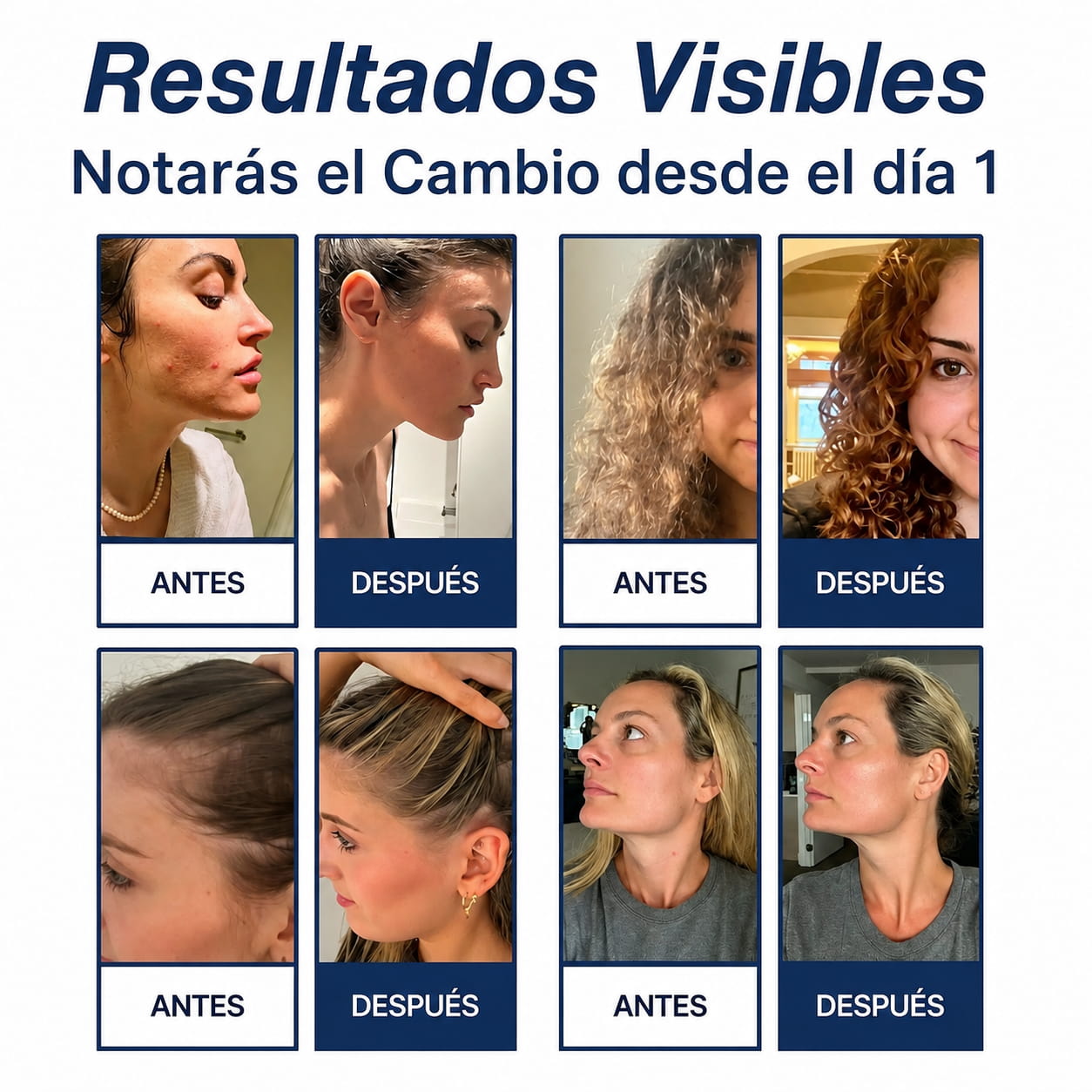 Dale a Tu Piel, Tu Pelo y Tu Salud el cuidado que merecen con Veika.
